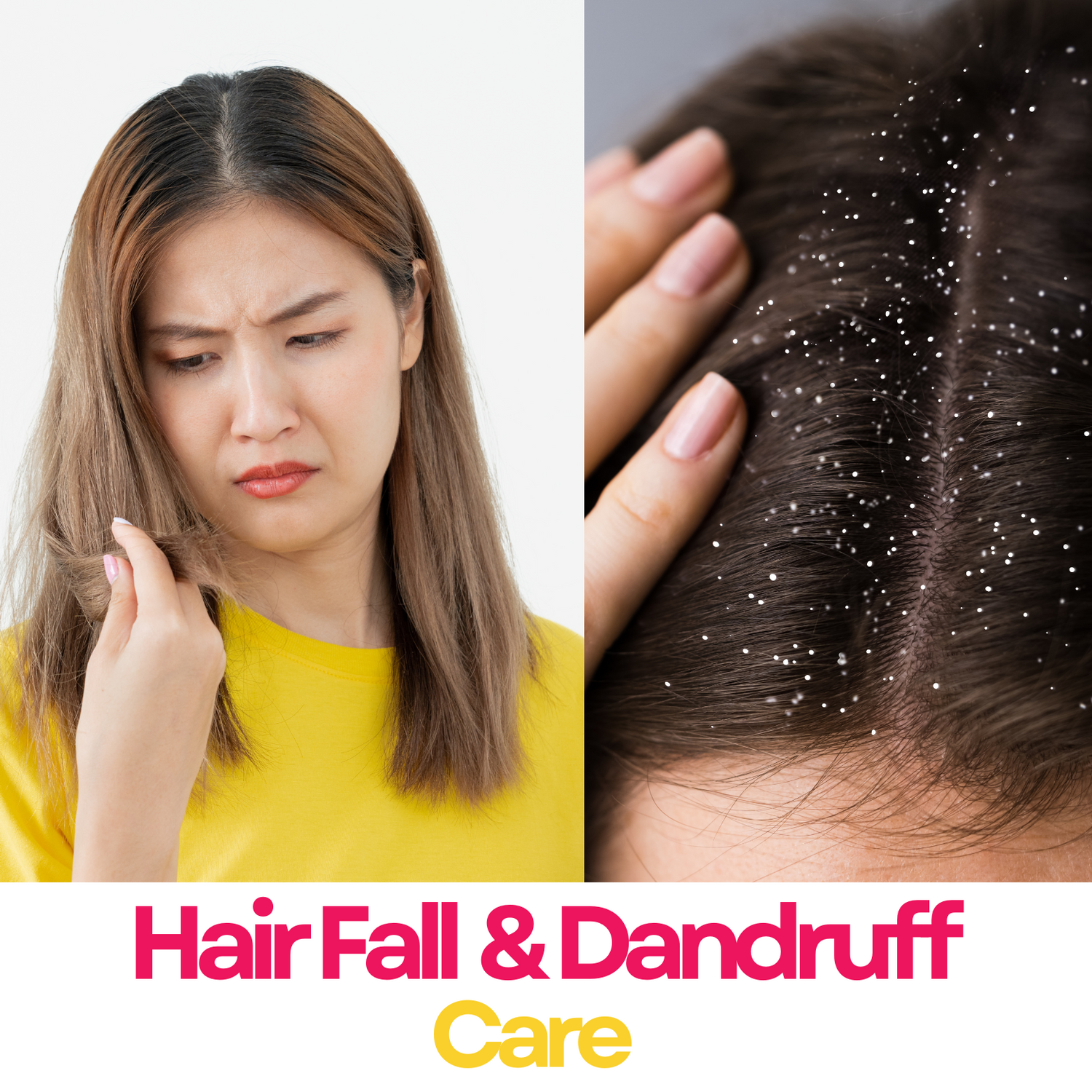 Hairfall & Dandruff care