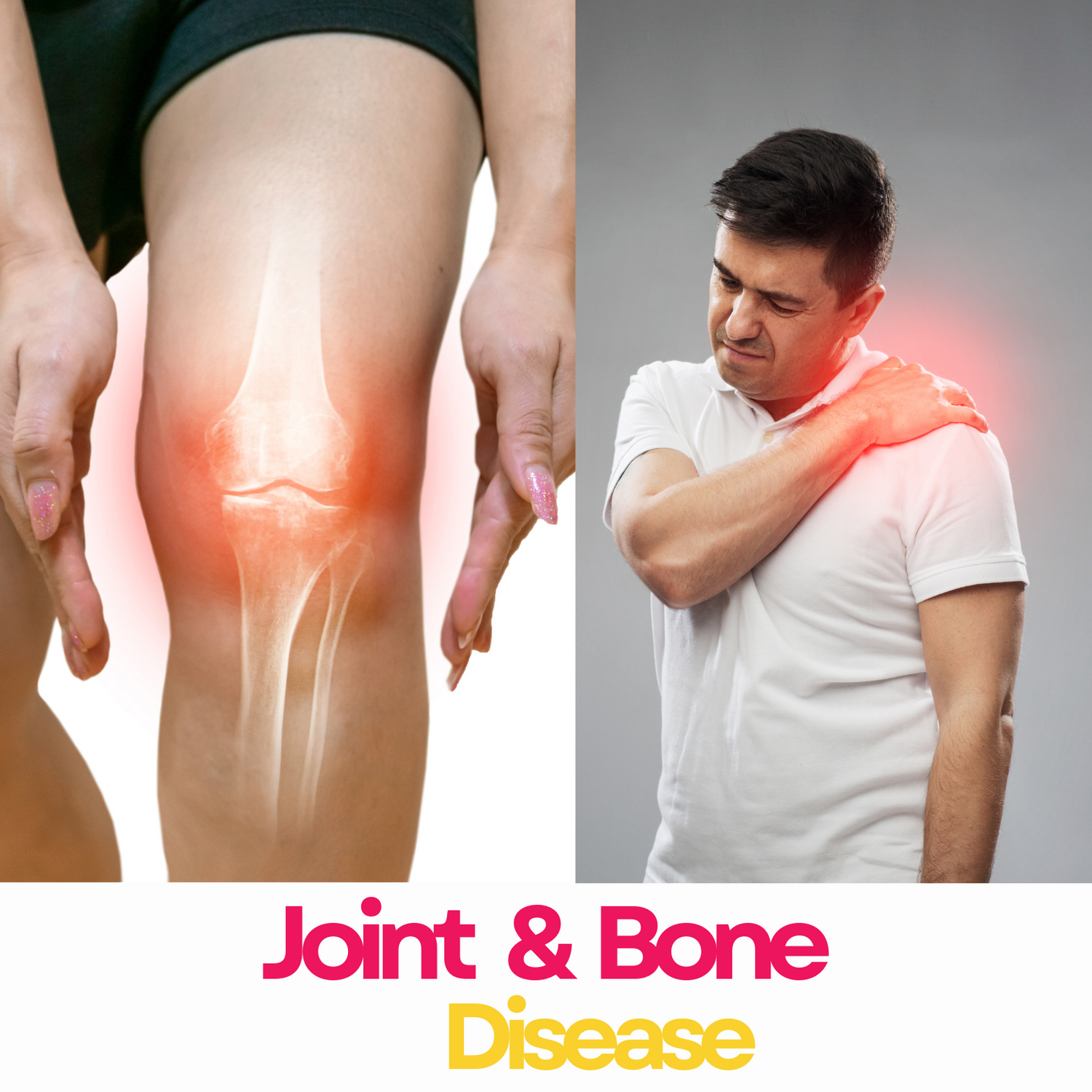 Joint & Bone Disease